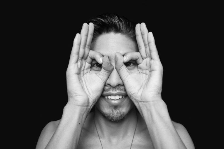 Why You Get Dark Circles Despite Sleeping Well (Hidden Causes)